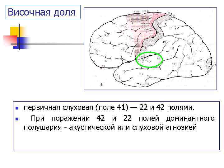 Височной извилины