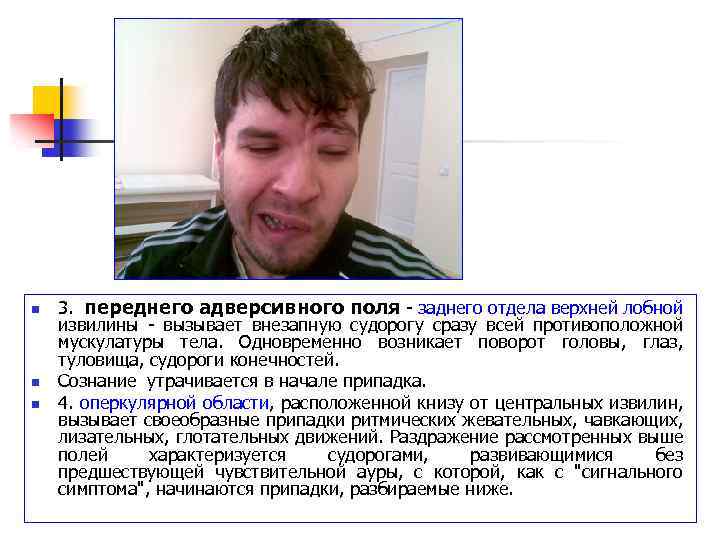 n n n 3. переднего адверсивного поля - заднего отдела верхней лобной извилины -