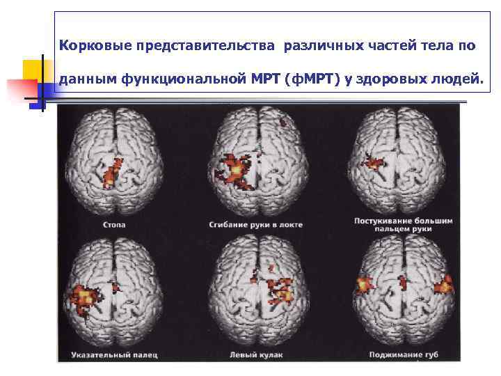  Корковые представительства различных частей тела по данным функциональной МРТ (ф. МРТ) у здоровых