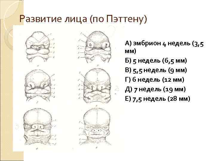 Развитие лица (по Пэттену)    А) эмбрион 4 недель (3, 5 
