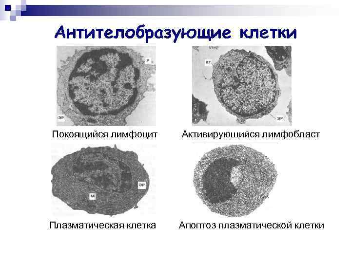 Антителобразующие клетки Покоящийся лимфоцит Активирующийся лимфобласт Плазматическая клетка  Апоптоз плазматической клетки 