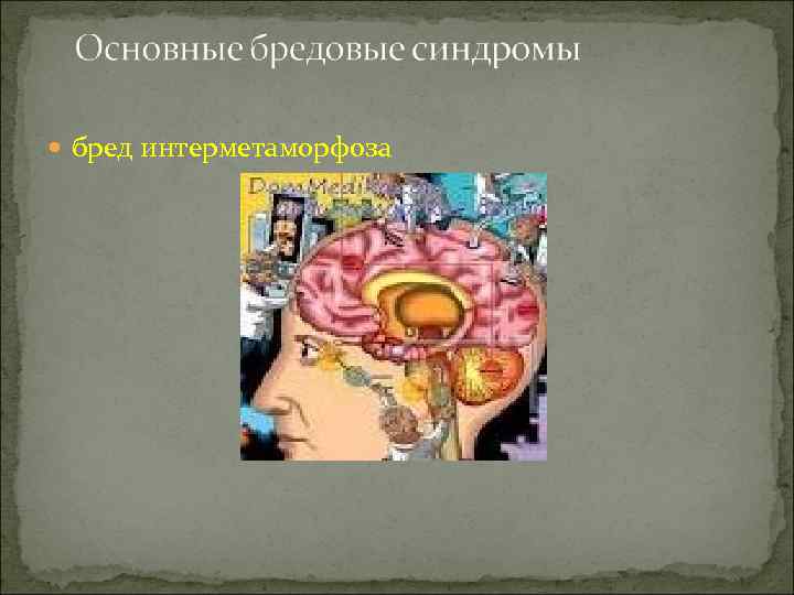  бред интерметаморфоза 