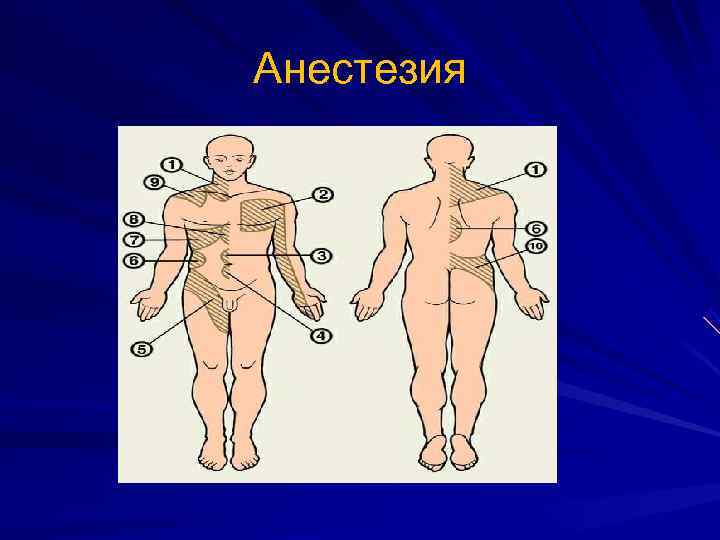 Анестезия 