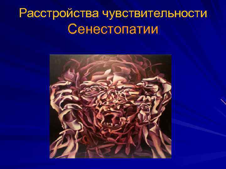 Расстройства чувствительности  Сенестопатии 