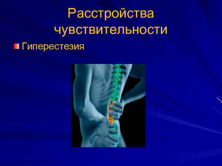   Расстройства  чувствительности Гиперестезия 