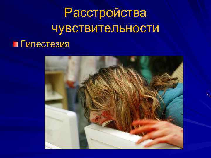   Расстройства  чувствительности Гипестезия 