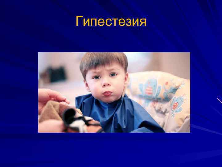 Гипестезия 