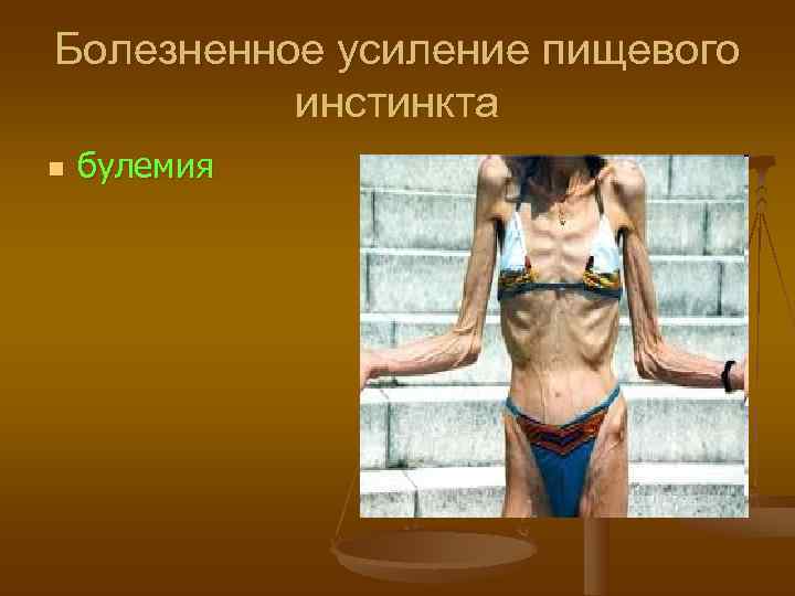 Болезненное усиление пищевого  инстинкта n  булемия 
