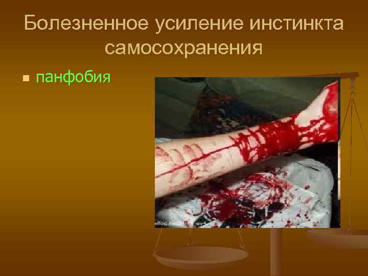 Болезненное усиление инстинкта  самосохранения n  панфобия 