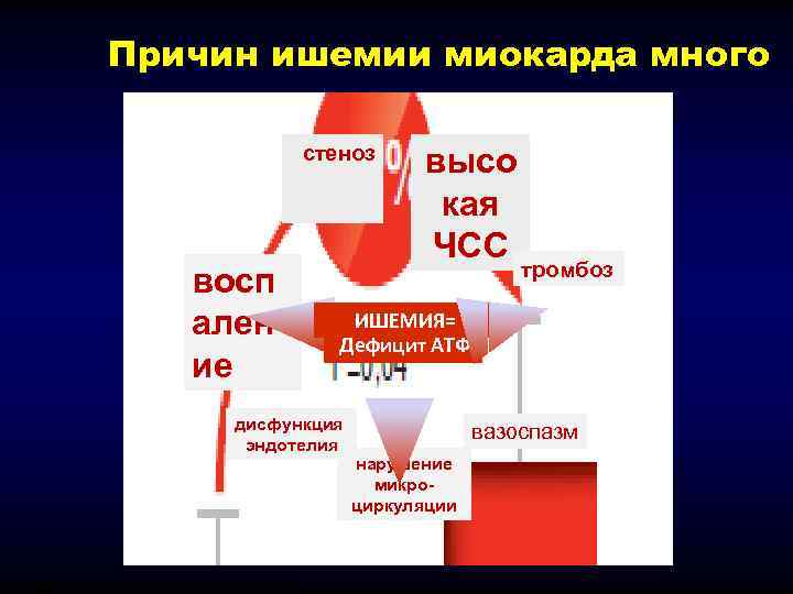    Причин ишемии миокарда много     стеноз  