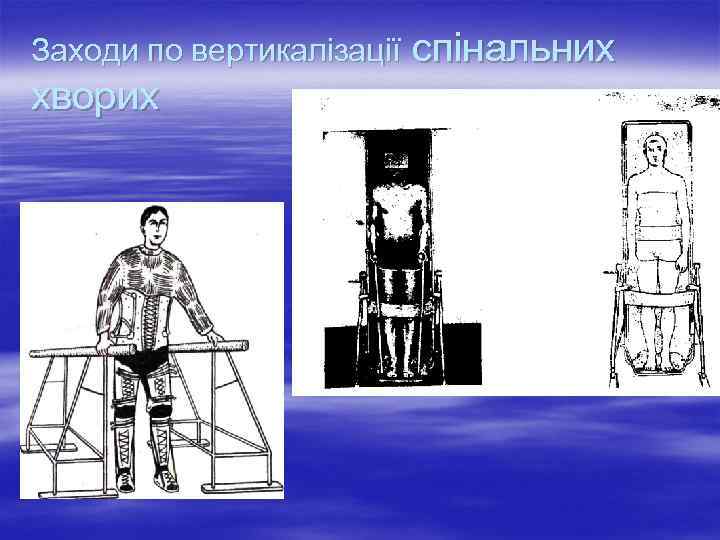Заходи по вертикалізації  спінальних хворих 