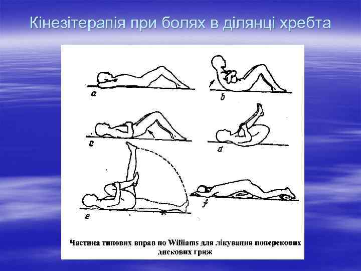 Кінезітерапія при болях в ділянці хребта 