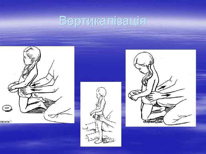 Вертикалізація 