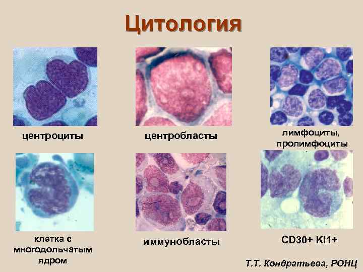 Иммунобласты в крови фото