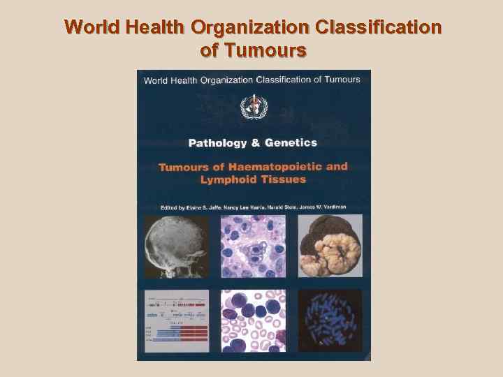 World Health Оrganization Classification    of Tumours 