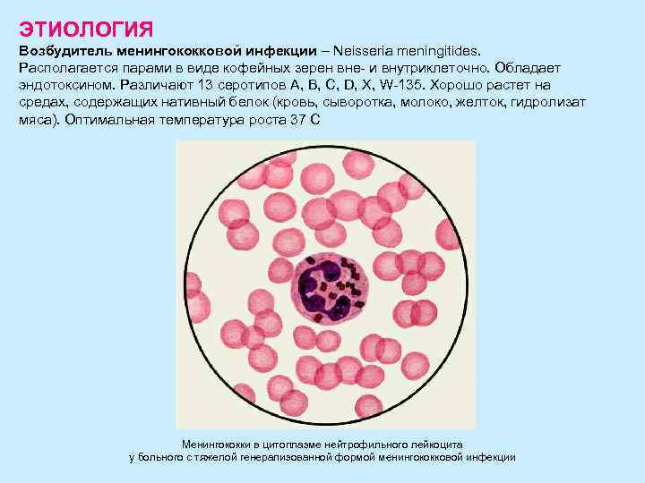 ЭТИОЛОГИЯ Возбудитель менингококковой инфекции – Neisseria meningitides. Располагается парами в виде кофейных зерен вне-