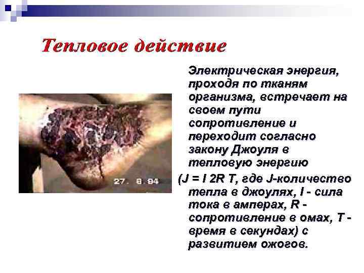   Электрическая энергия,  проходя по тканям организма, встречает на своем пути сопротивление