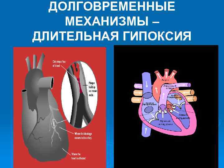 ДОЛГОВРЕМЕННЫЕ МЕХАНИЗМЫ – ДЛИТЕЛЬНАЯ ГИПОКСИЯ ДОЛГОВРЕМЕННЫЕ МЕХАНИЗМЫ – ДЛИТЕЛЬНАЯ ГИПОКСИЯ