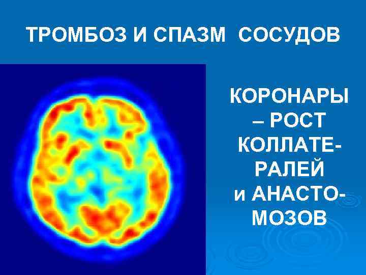 ТРОМБОЗ И СПАЗМ СОСУДОВ КОРОНАРЫ – РОСТ ТРОМБОЗ И СПАЗМ СОСУДОВ КОРОНАРЫ – РОСТ