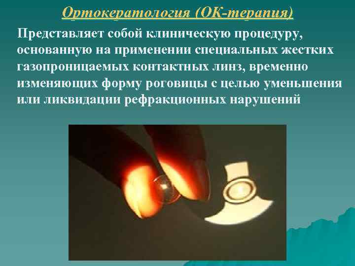  Ортокератология (ОК-терапия) Представляет собой клиническую процедуру, основанную на применении специальных жестких газопроницаемых контактных