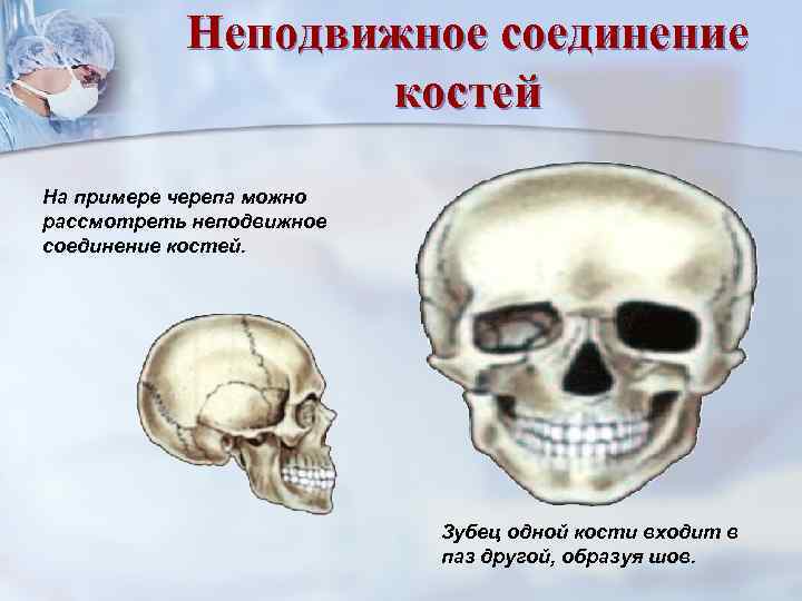 Череп неподвижный. Неподвижные кости черепа. Неподвижное соединение черепа. Кости черепа соединены неподвижно. Неподвижное и неподвижное соединение костей черепа.