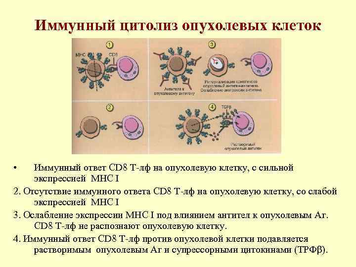   Иммунный цитолиз опухолевых клеток • Иммунный ответ CD 8 Т-лф на опухолевую