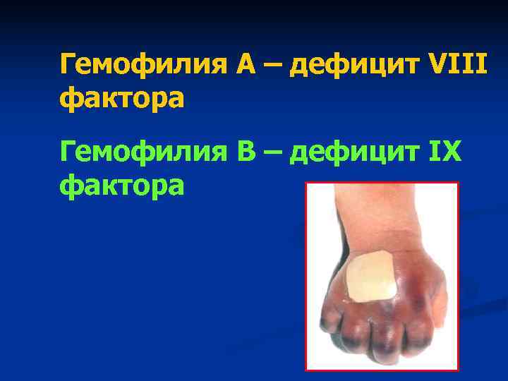 Гемофилия А – дефицит VIII фактора Гемофилия В – дефицит IX фактора Гемофилия А – дефицит VIII фактора Гемофилия В – дефицит IX фактора