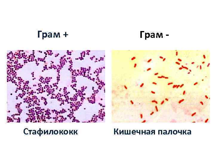  Грам +  Грам - Стафилококк  Кишечная палочка 