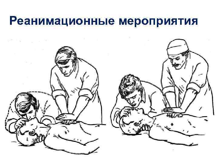 Реанимационные мероприятия 