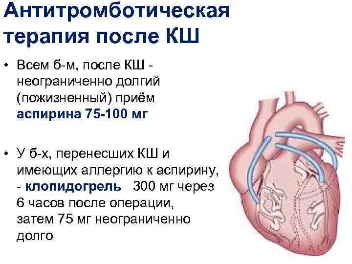 Антитромботическая терапия после КШ • Всем б-м, после КШ -  неограниченно долгий 