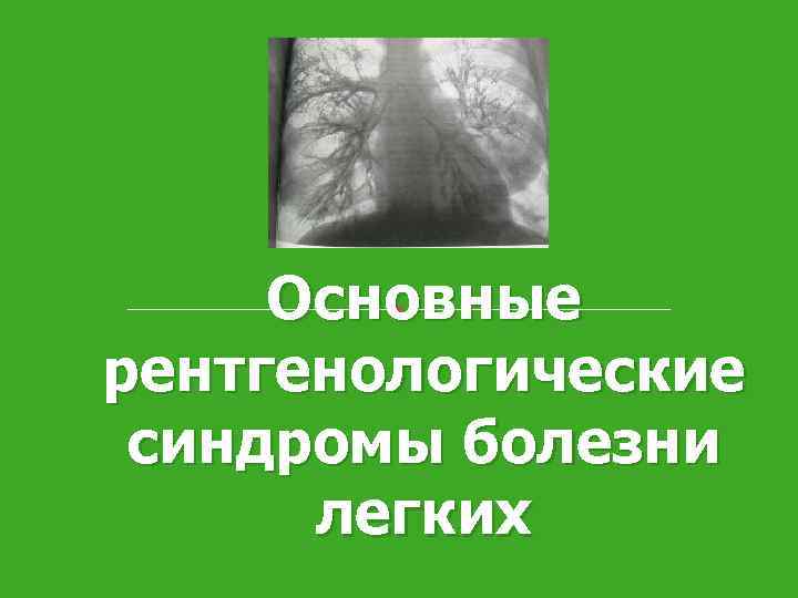Основные рентгенологические синдромы болезни легких 