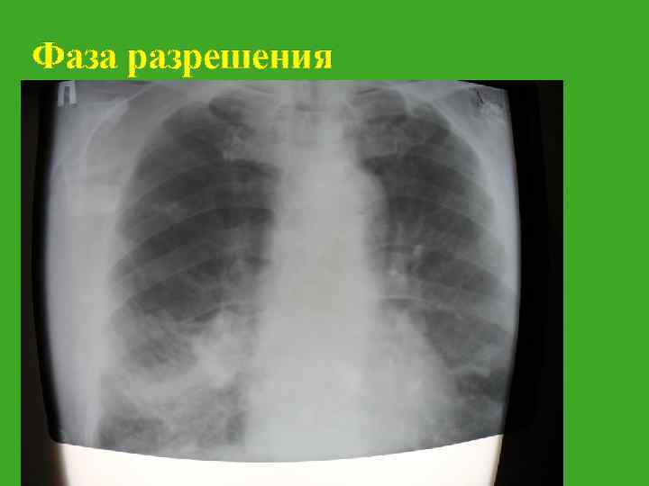 Фаза разрешения 