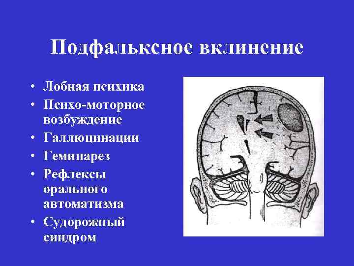 Открытая черепно мозговая травма карта вызова смп