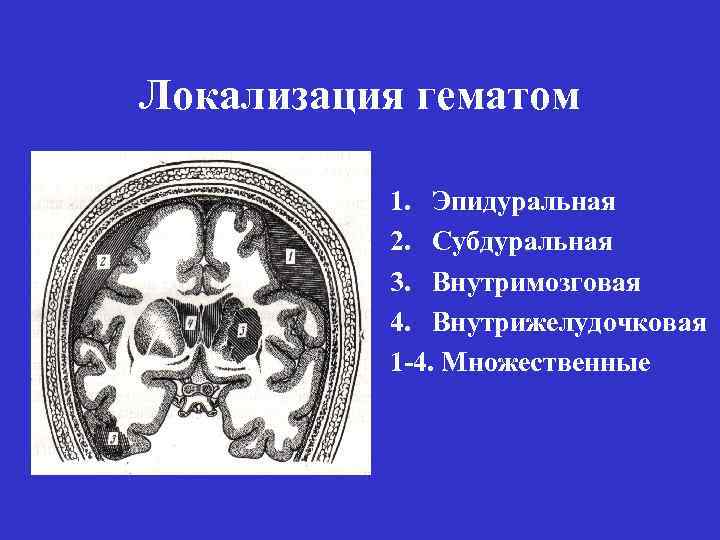 Локализация гематом 1. Эпидуральная 2. Субдуральная 3. Внутримозговая 4. Внутрижелудочковая 1 -4. Множественные 