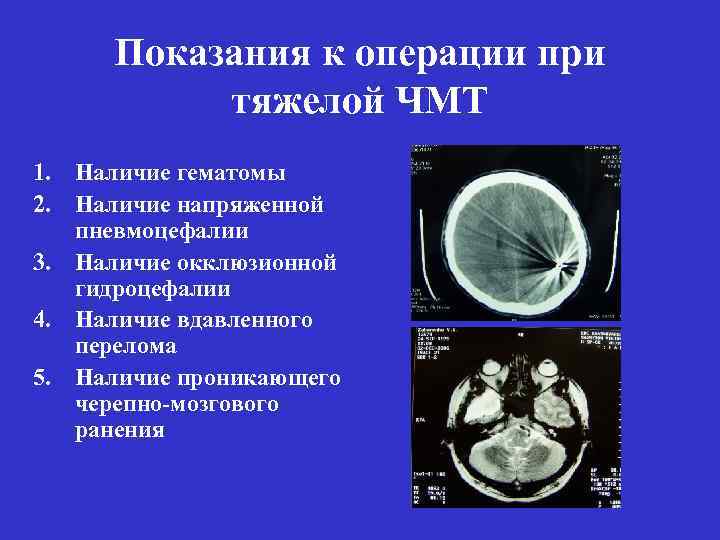 Открытая черепно мозговая травма карта вызова смп