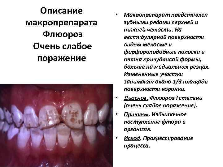   Описание  • Макропрепарат представлен макропрепарата зубными рядами верхней и  