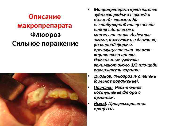      • Макропрепарат представлен    зубными рядами верхней