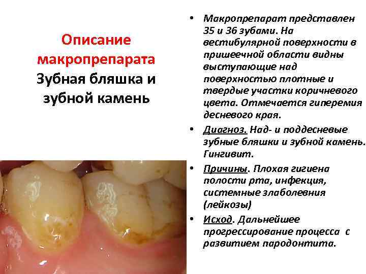    • Макропрепарат представлен     35 и 36