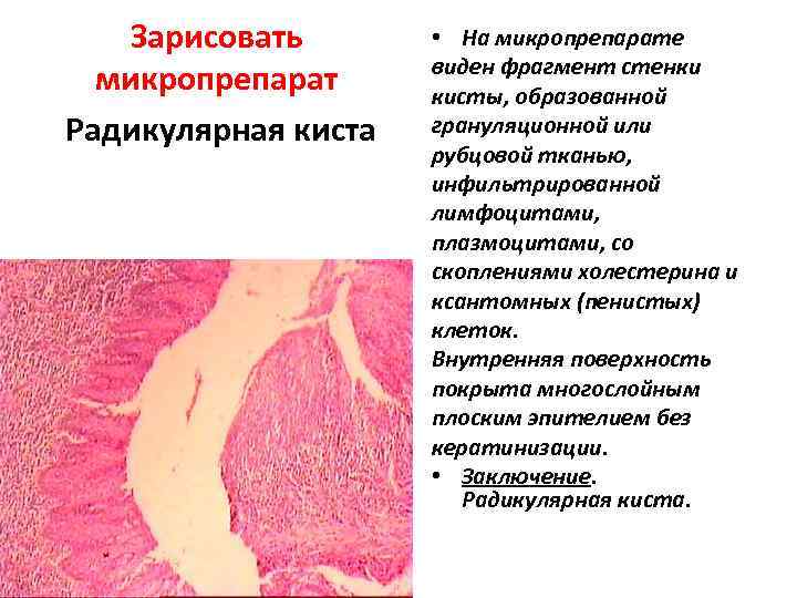   Зарисовать   • На микропрепарате     виден фрагмент