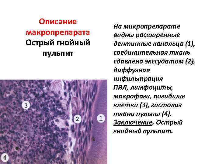 Чума патологическая анатомия презентация