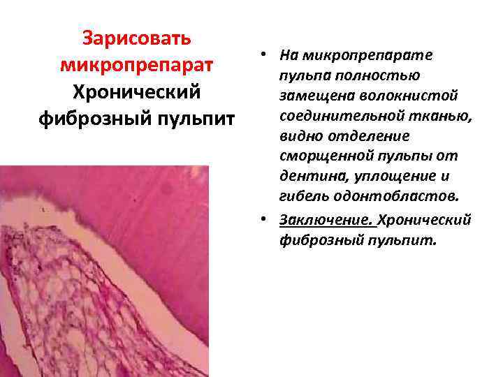   Зарисовать     • На микропрепарате  микропрепарат  пульпа
