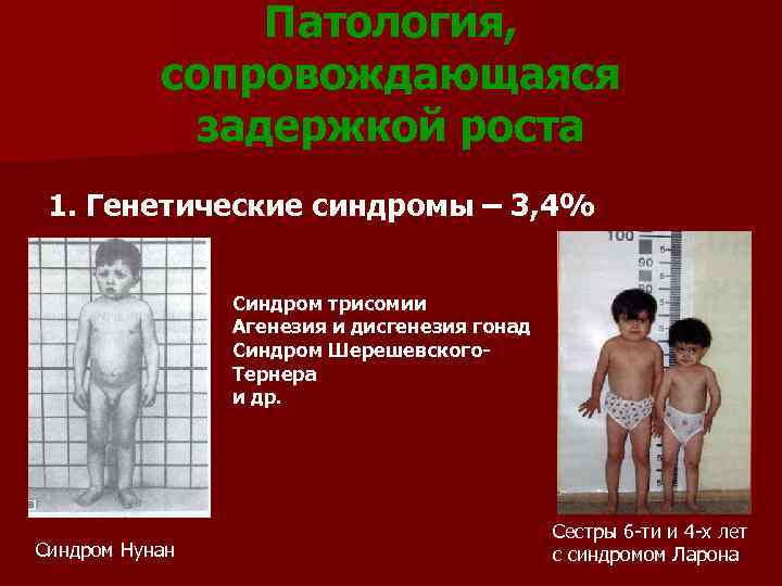     Патология,   сопровождающаяся   задержкой роста 1. Генетические