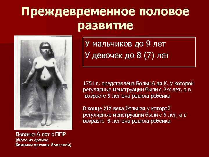  Преждевременное половое   развитие     У мальчиков до 9