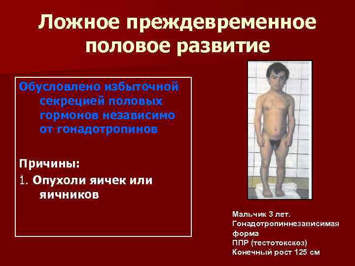  Ложное преждевременное половое развитие Обусловлено избыточной  секрецией половых  гормонов независимо 