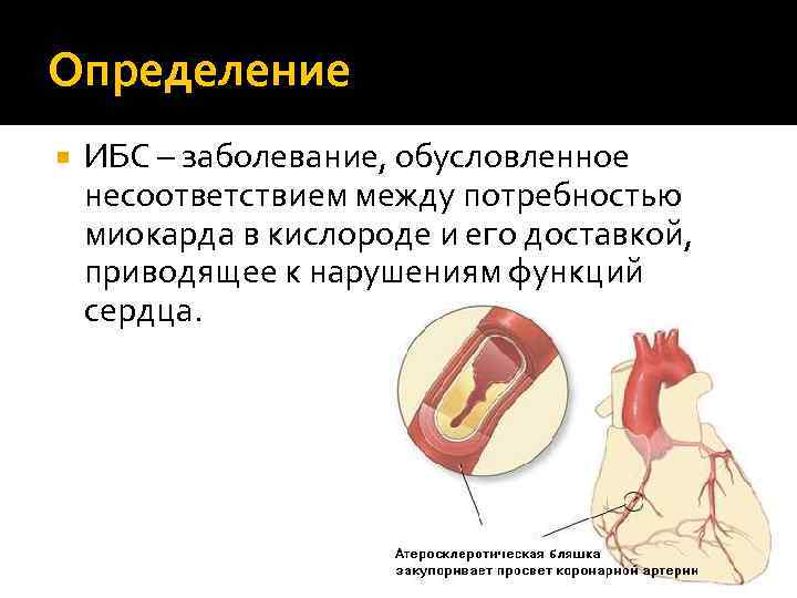 Определение ИБС – заболевание, обусловленное несоответствием между потребностью миокарда в кислороде и его доставкой,