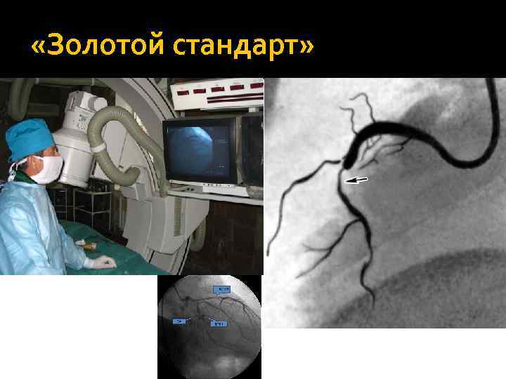 «Золотой стандарт» 