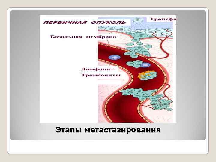 Этапы метастазирования 