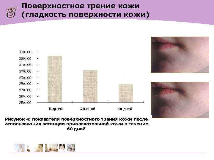  Поверхностное трение кожи  (гладкость поверхности кожи)     0 дней