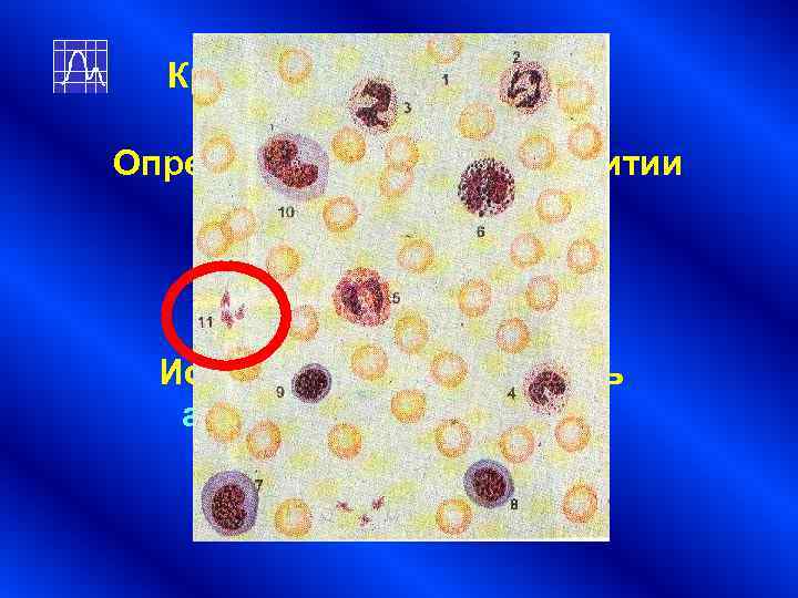 Критерий Уилкоксона Определенную роль в развитии этого заболевания играют тромбоциты Исследовался показатель Критерий Уилкоксона Определенную роль в развитии этого заболевания играют тромбоциты Исследовался показатель