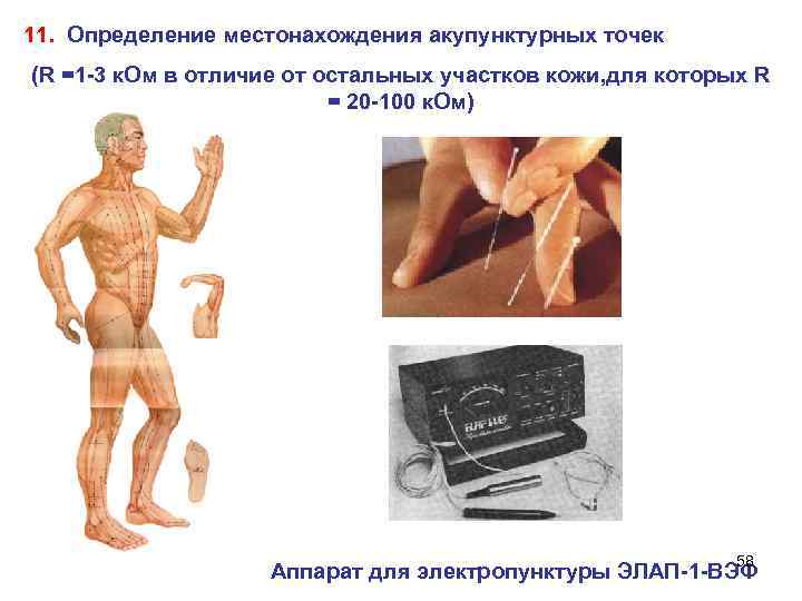 11. Определение местонахождения акупунктурных точек (R =1 -3 к. Ом в отличие от остальных